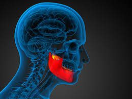 Temporomandibular Joint Pain