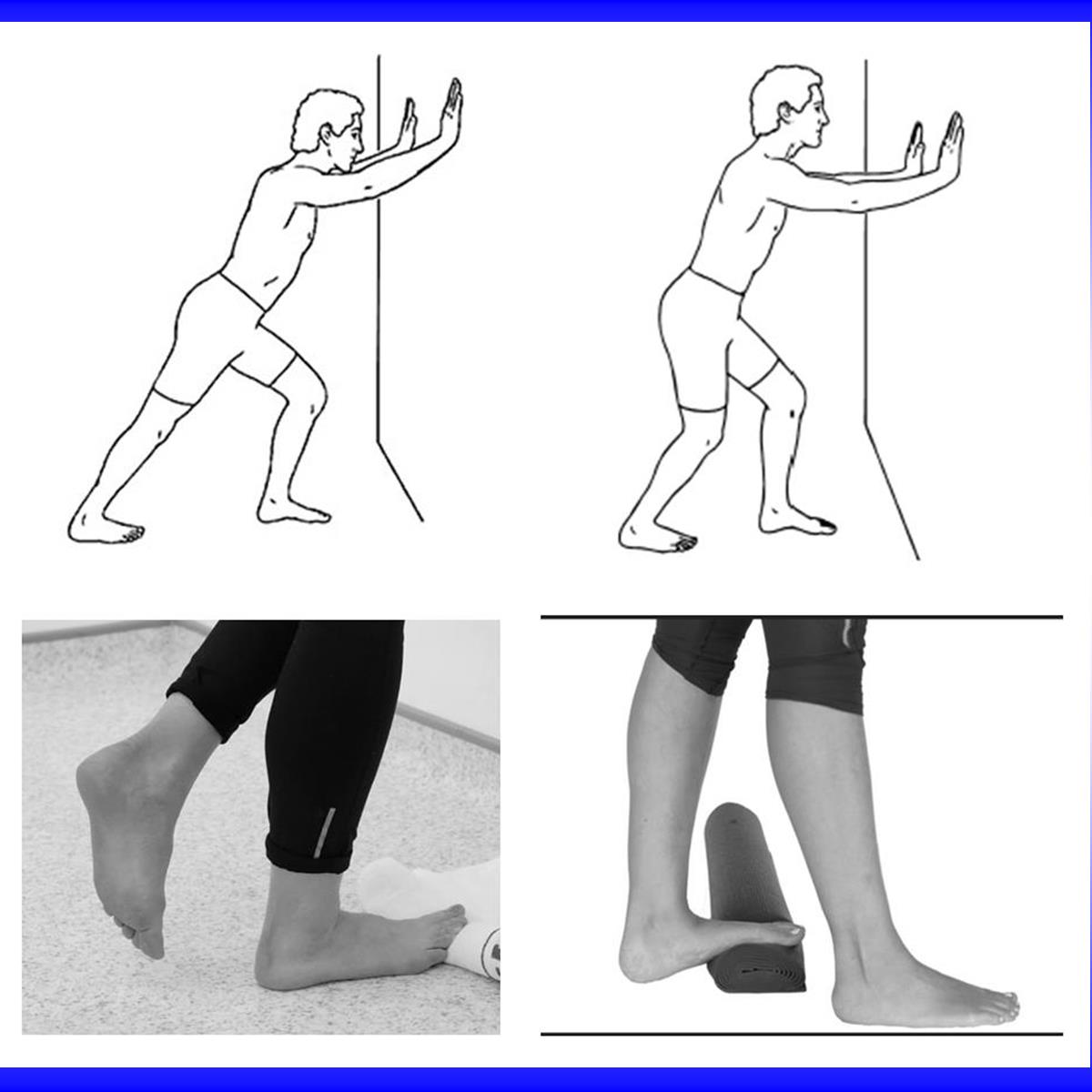 Stretching for Plantar Fasciitis